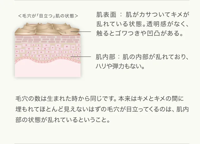 毛穴の数は生まれた時から同じです。本来はキメとキメの間に埋もれてほとんど見えないはずの毛穴が目立ってくるのは、肌内部の状態が乱れているということ。