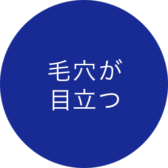 毛穴が目立つ