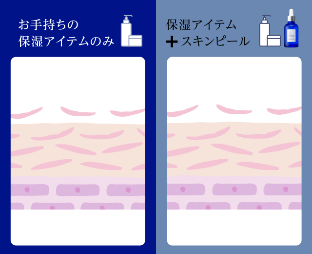 保湿アイテム＋スキンピール